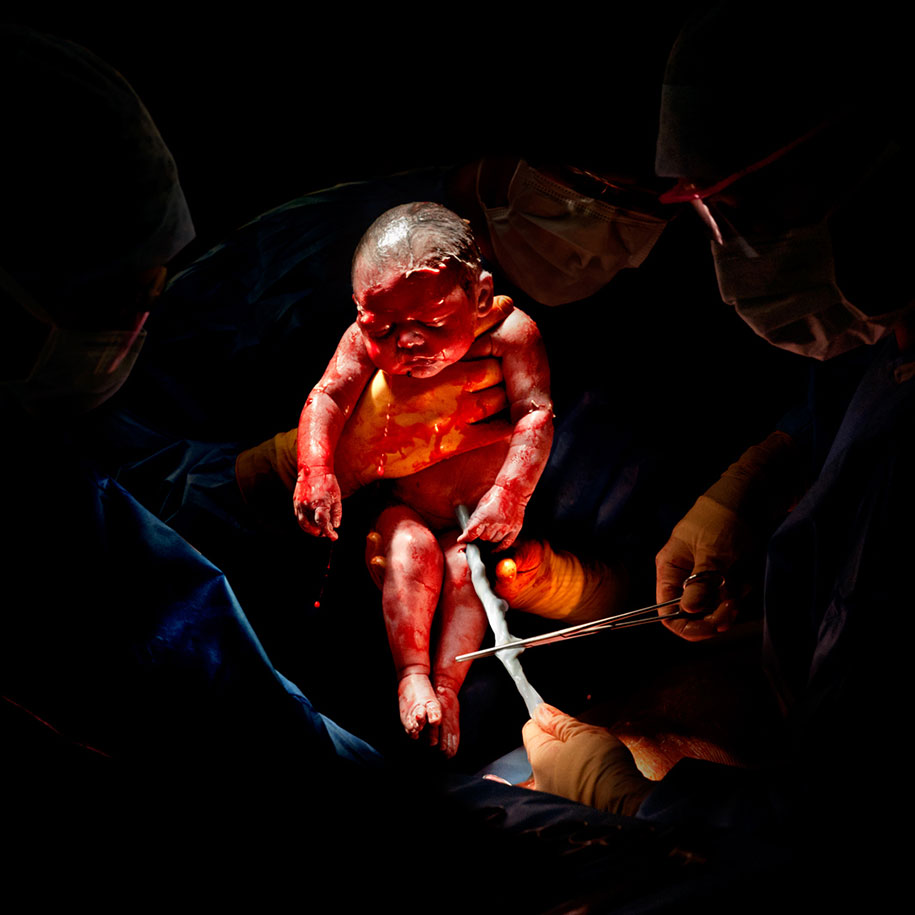 newbornc-section-cesar-photos-c-section-cesar-christian-berthelot-3