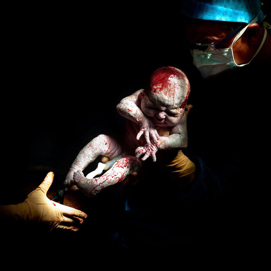 newbornc-section-cesar-photos-c-section-cesar-christian-berthelot-7