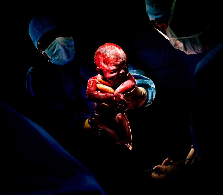 newbornc-section-cesar-photos-c-section-cesar-christian-berthelot-9