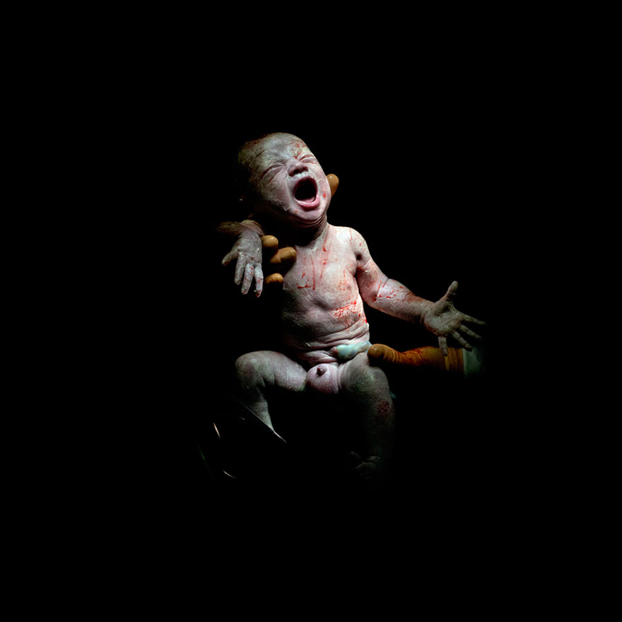 newborn-infant-photos-c-section-cesar-christian-berthelot-3