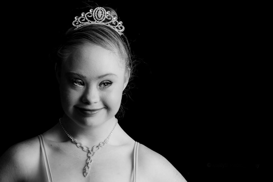 A Teen With Down Syndrome Just Landed A Modelling Contract Bored Panda 