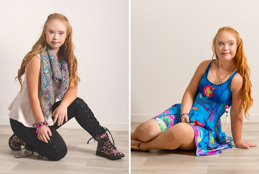 Maddy Stuart Teen With Down Syndrome Lands Her First Modelling Contract Positive Vibes