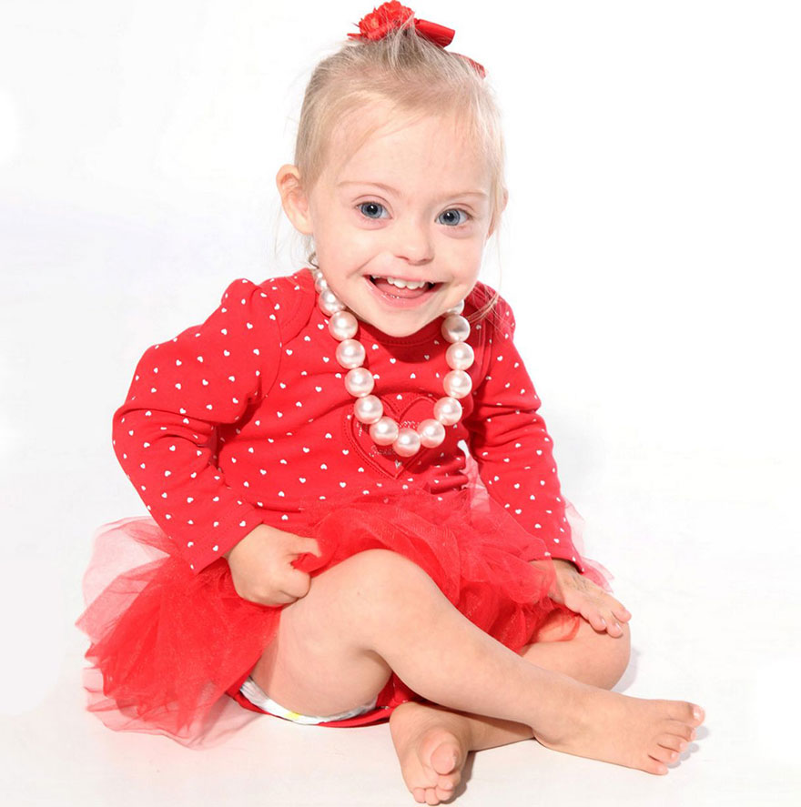 2 Year Old Girl With Down Syndrome Wins Modeling Contract Thanks To Her 