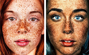 Unique Beauty Of Freckled People Documented By Brock Elbank