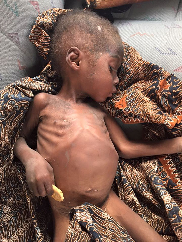 nigerian-starving-thirsty-boy-hope-rescued-anja-ringgren-loven-23