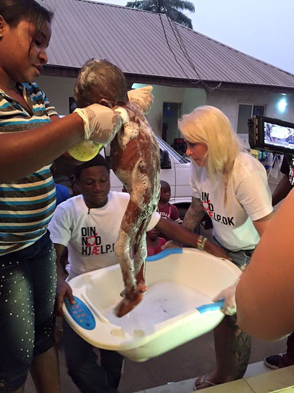 nigerian-starving-thirsty-boy-hope-rescued-anja-ringgren-loven-25