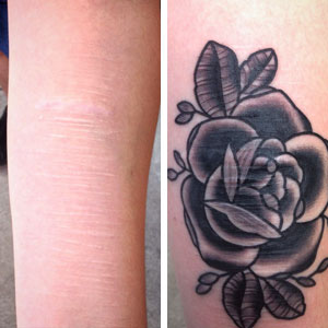 Seattle tattoo artist makes mastectomy scars beautiful 
