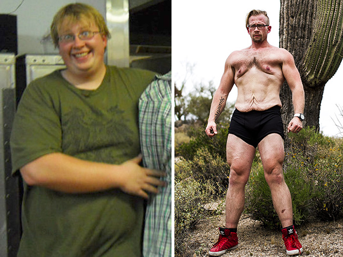 I Used To Weight 400 Lbs! Over 250 Lbs Of Weight Manipulation And Six