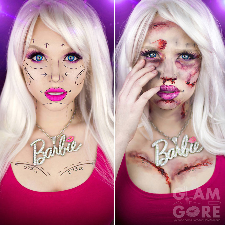 Barbie Antes e depois Cirurgias Plásticas falhados