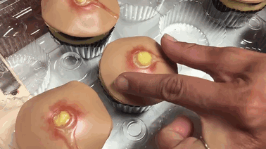 pimple-cupcakes-dr-pimple-popper-blessed-by-baking-3.gif