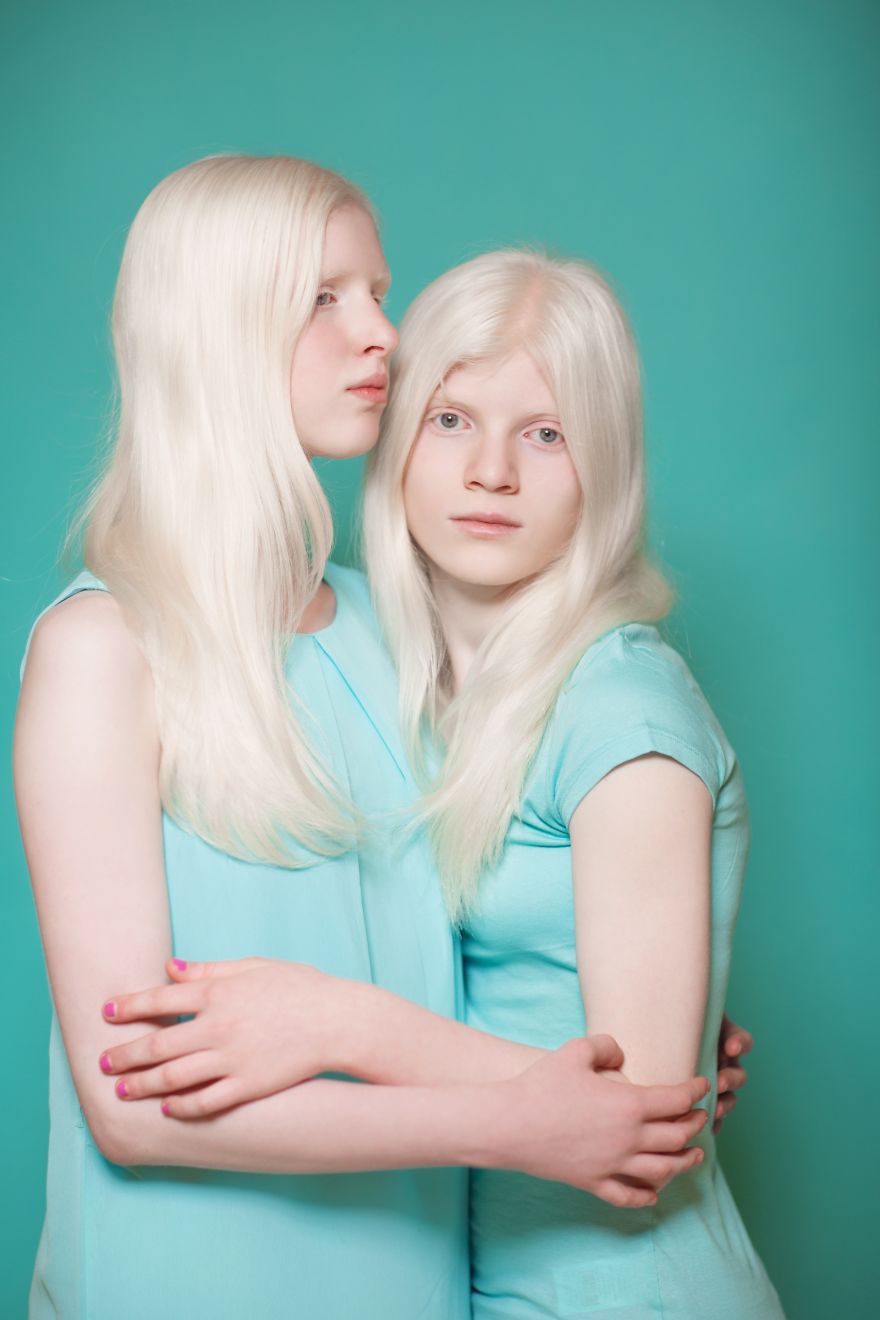  took photographs albino kids show their pure beauty 