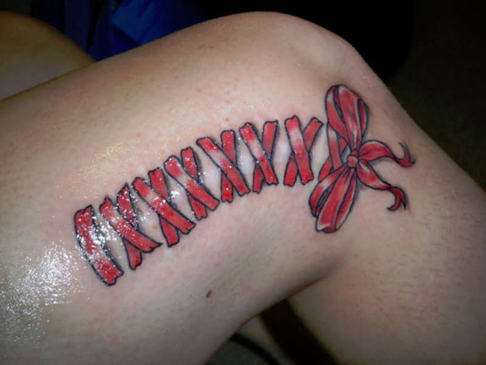 A Ribbon Covering A Tumor Removal Scar