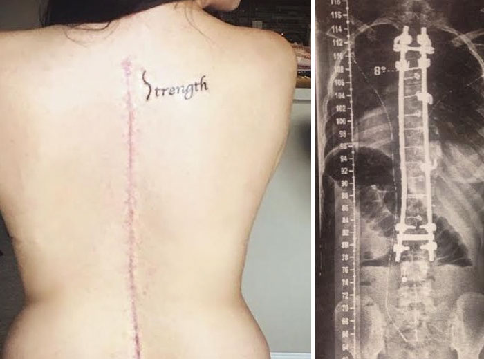 10 Scar Covering Tattoos With Amazing Stories Behind Them Bored Panda