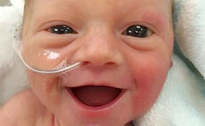 Premature Baby Smiles From Ear To Ear 5 Days After Being Born