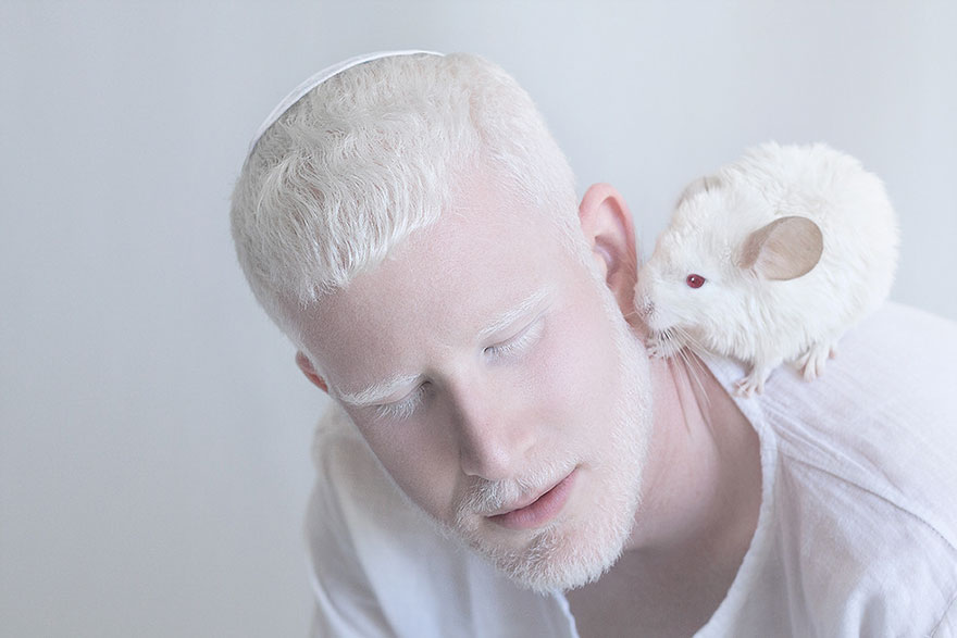 http://www.boredpanda.com/beautiful-albino-people-albinism/