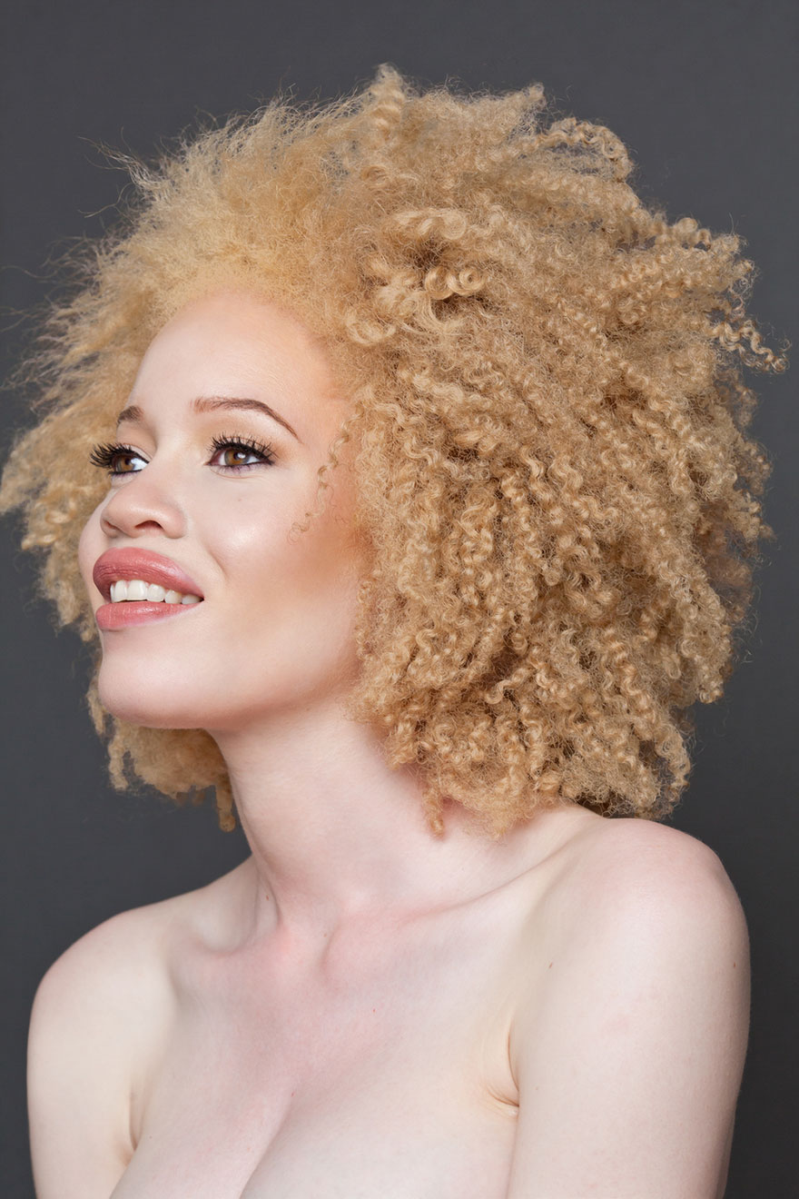 15 Albino People Wholl Mesmerize You With Their Otherworldly Beauty