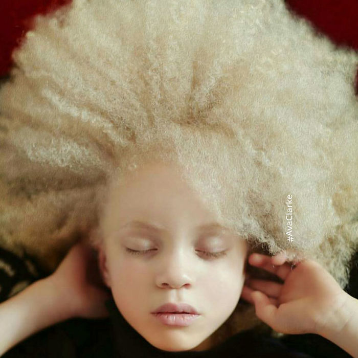  albino people who mesmerize their otherworldly 