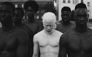 15+ Albino People Who'll Mesmerize You With Their Otherworldly Beauty