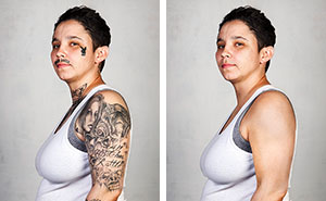 9 Ex-Gang Members With Their Tattoos Removed
