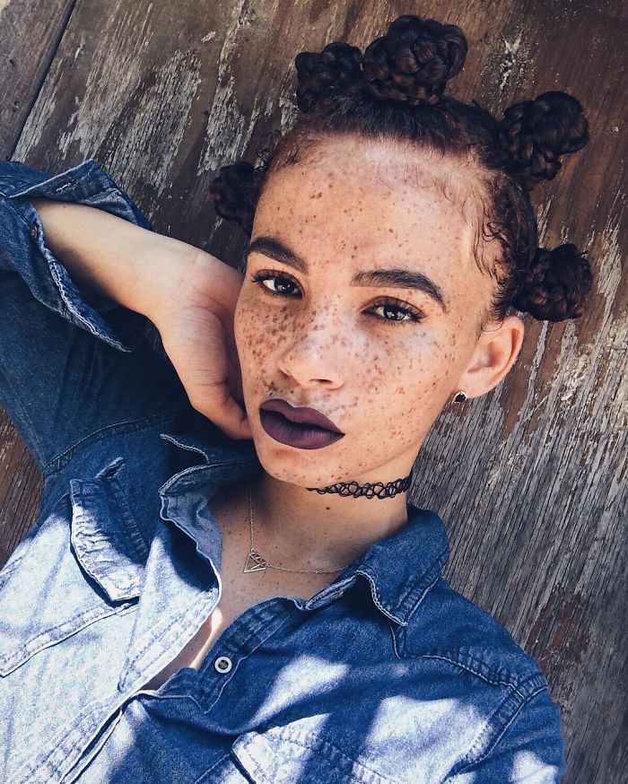 15 Freckled People Who Ll Hypnotize You With Their Unique Beauty