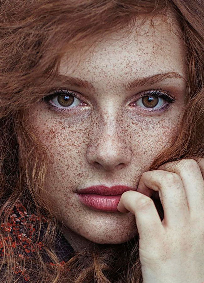 and freckles Redhead