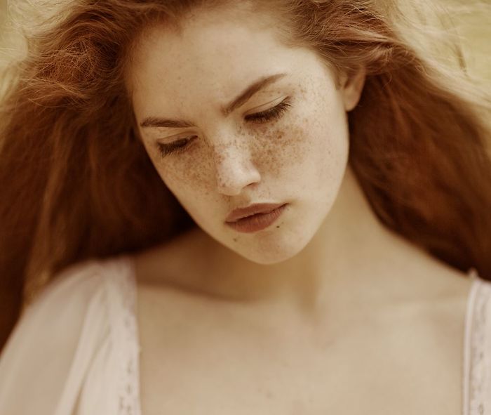 15 Freckled People Wholl Hypnotize You With Their Unique Beauty 