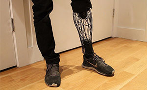 Incredible See-Through Prosthetics 3D-Printed From Titanium