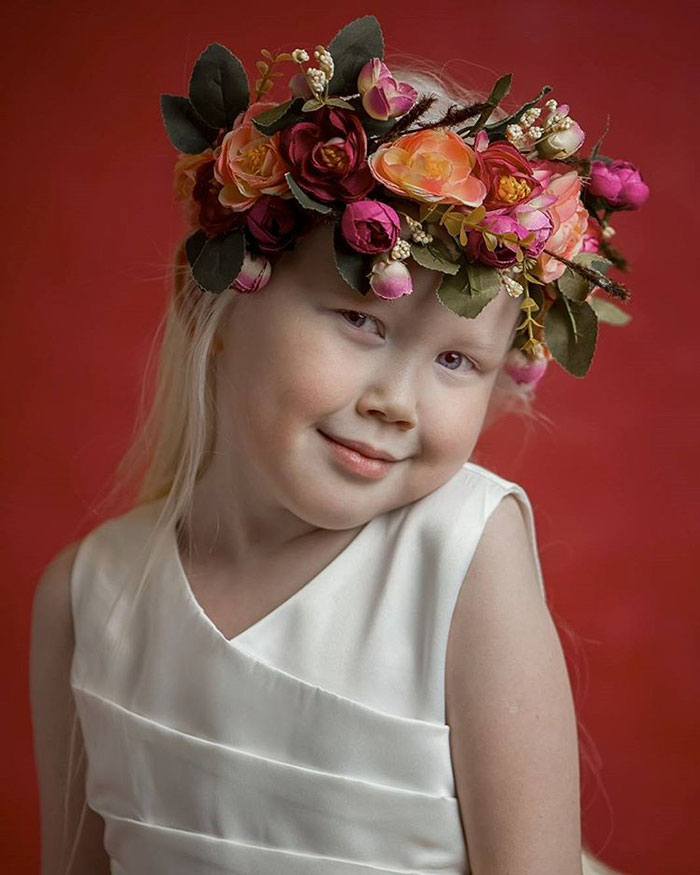 albino-girl-snow-white-nariyana-siberia-17