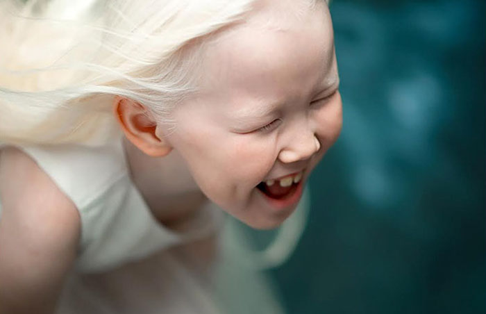 albino-girl-snow-white-nariyana-siberia-2