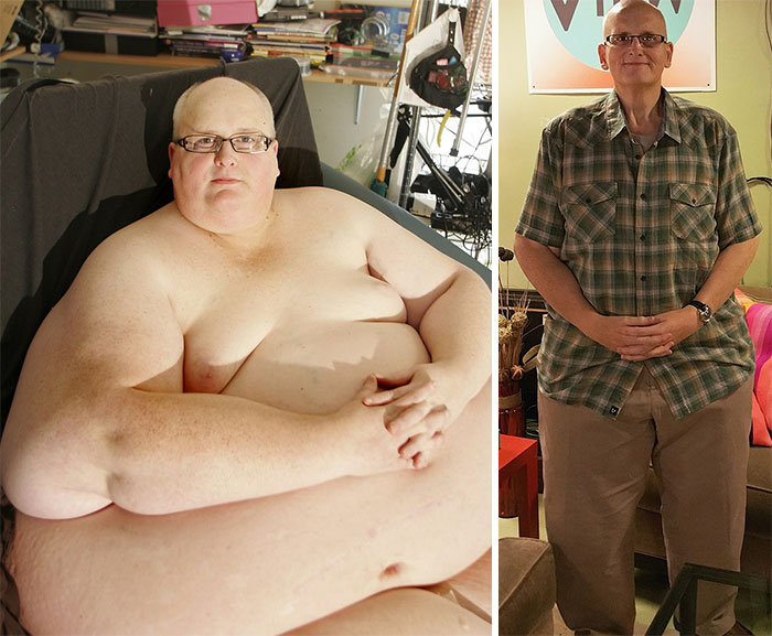 El hombre más obeso del mundo después de bajar 315 kilos