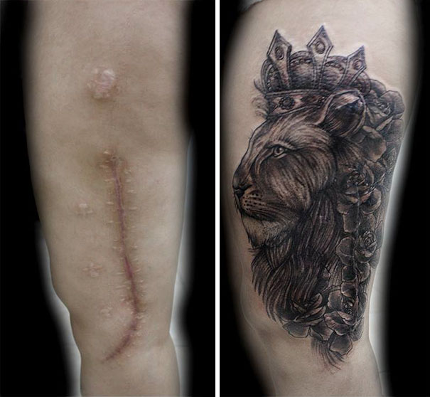 Impresionantes tatuajes que convirtieron las cicatrices en obras de arte