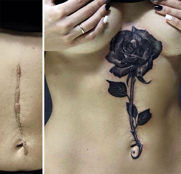 Impresionantes tatuajes que convirtieron las cicatrices en obras de arte