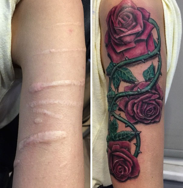 10+ Amazing Tattoos That Turn Scars Into Works Of Art