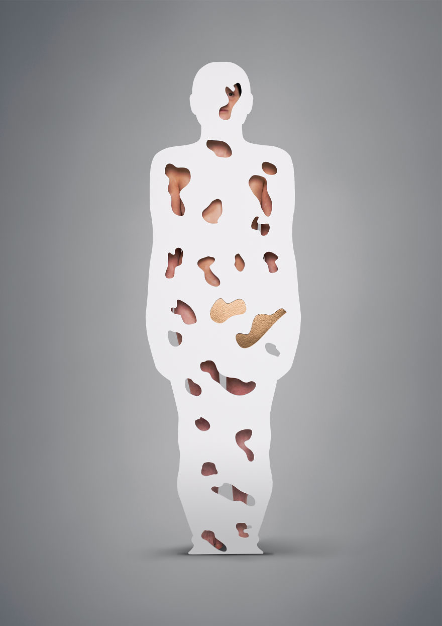  vitiligo skin 