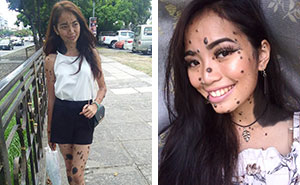 Woman Who Was Called A Monster For Her Head-To-Toe Hairy Moles Might Be The Next Miss Universe