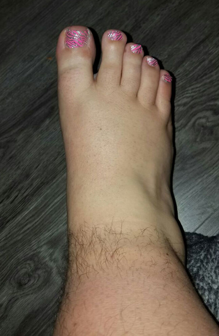 I Bet My Wife She Couldn't Shave My Foot Without Me Waking Up. This Is What I Woke Up To This Morning