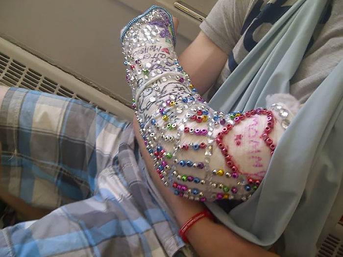 A Friend Of Mine Recently Broke His Arm. This Is What He Woke Up To After A Night Spent With Friends
