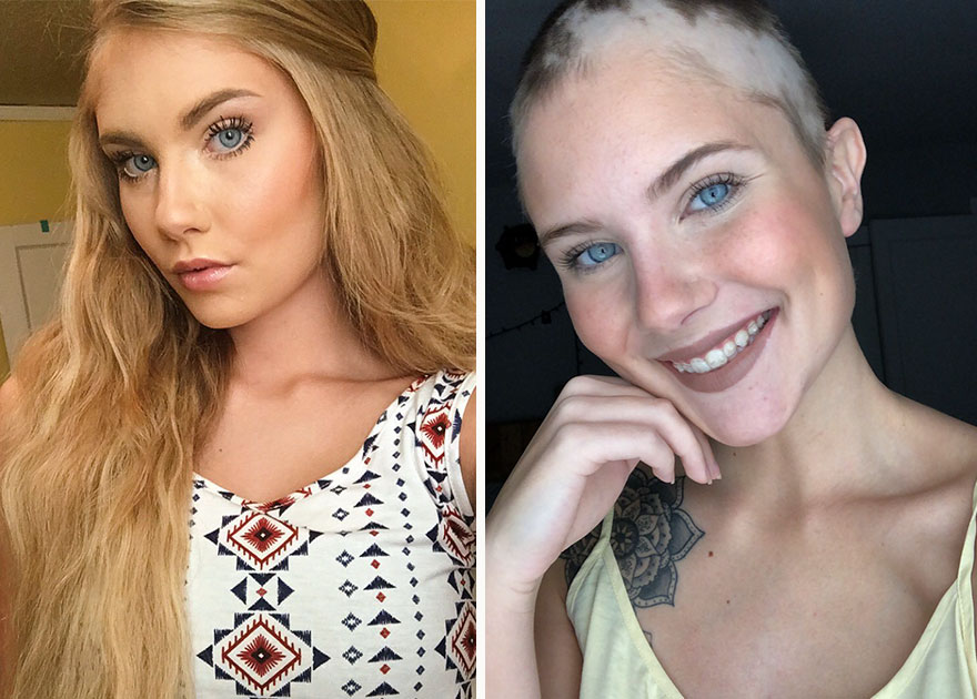 Mom Spends Hours Painting Daughters Bald Head For Her Senior Year Portraits, And The Result Is Beautiful
