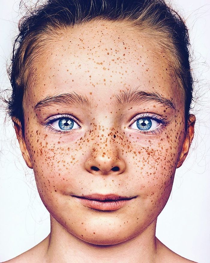 Photographer Takes Portraits Of Freckled People To Celebrate Their Unique Beauty