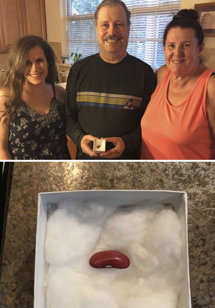 I Gave My Dad A Kidney Bean For Father’s Day. It Took Him A Second But He Finally Realized. I’m A Match To Donate A Kidney!