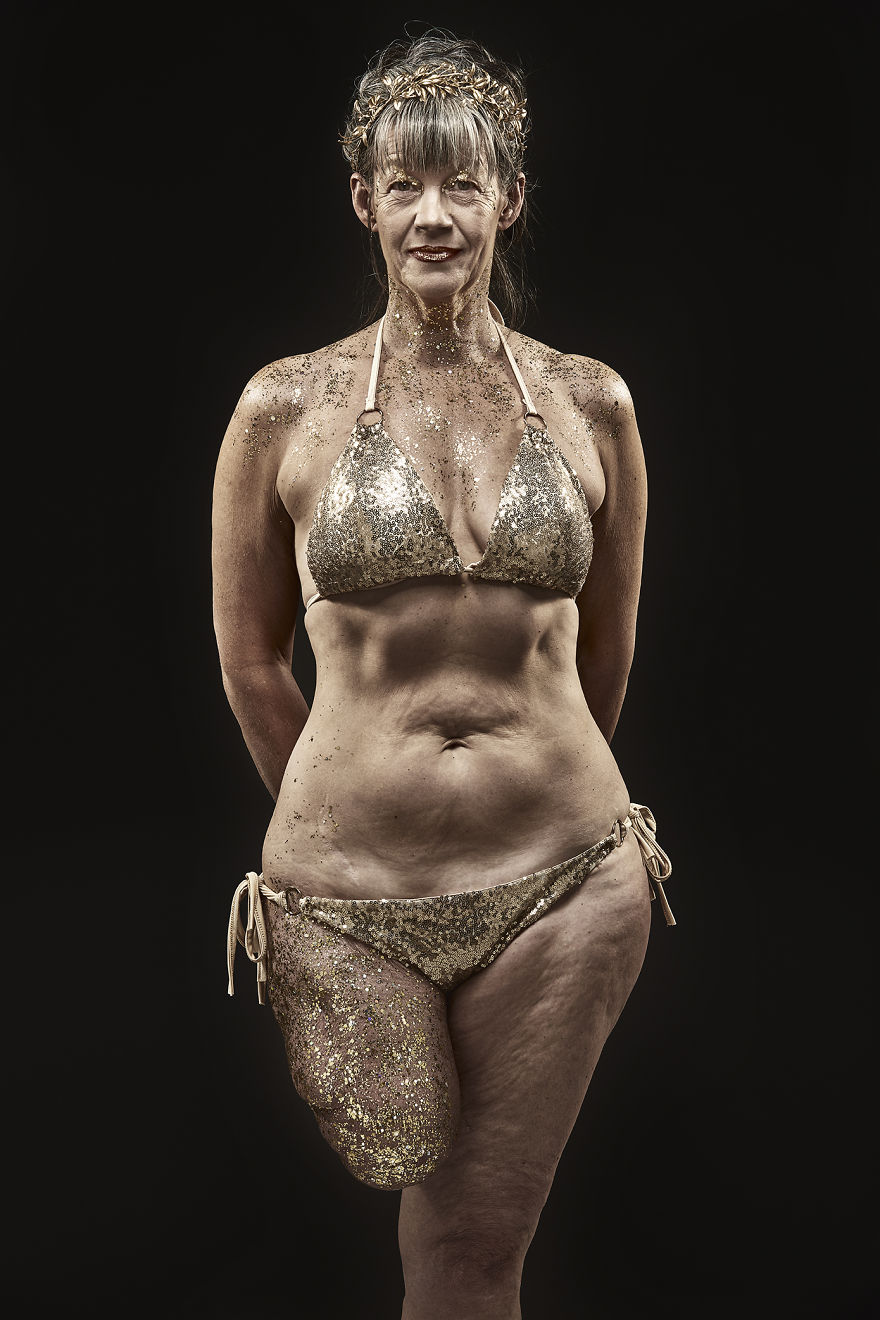 Our Newest Awareness Campaign Celebrates Diversity And The Beauty Of Lifes Scars