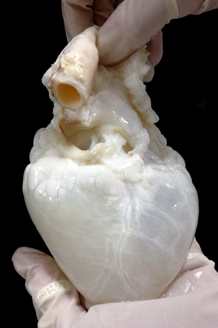 This Is How A Cleaned Heart Looks Like