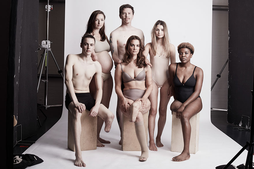 People Aged From 2 To 54 Posed For Our Photoshoot That Raises Awareness In Limb Differences (26 Pics)