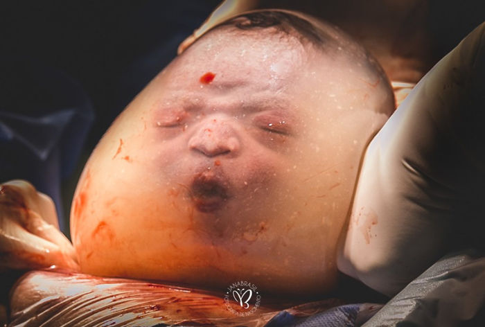 27 Stunning Birth Photos That Won The 2020 Birth Photography Competition
