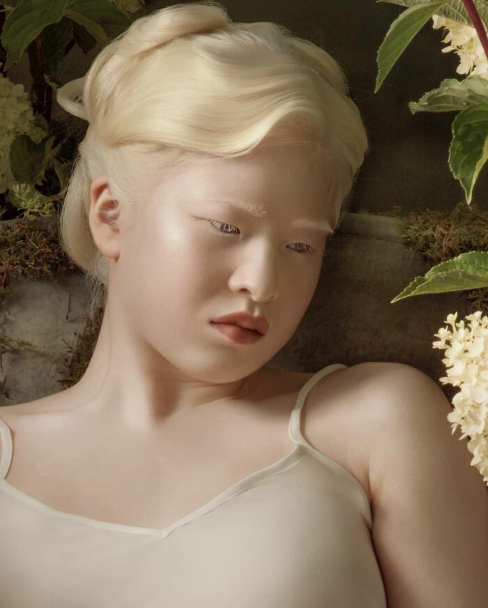 Xueli Was Abandoned As A Baby Due To Albinism; At Age 16, She Is Now A Fashion Model (64 Pics)