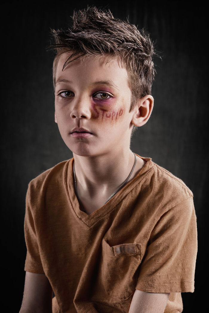 Weapon Of Choice: Shocking Project Shows That Words Hurt As Much As Punches