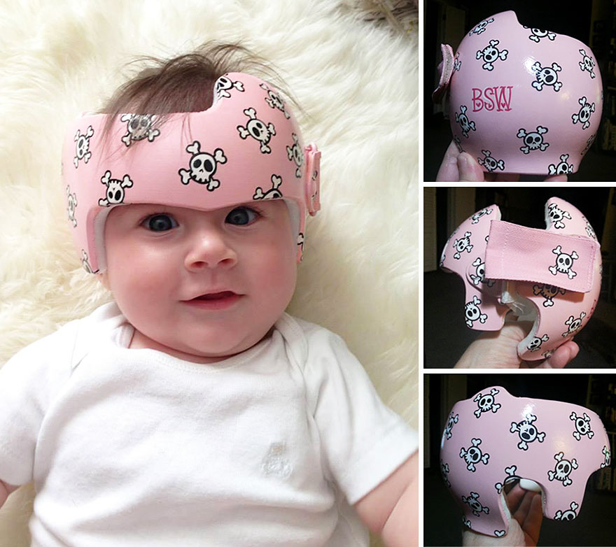 Artist Transforms Babies' Head-Shaping Helmets Into Beautiful Art