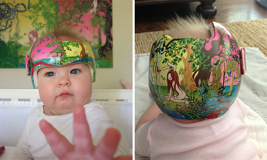 Artist Transforms Babies' Head-Shaping Helmets Into Beautiful Art