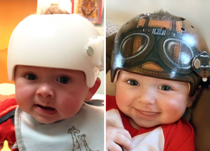 Artist Transforms Babies’ Head-Shaping Helmets Into Beautiful Art