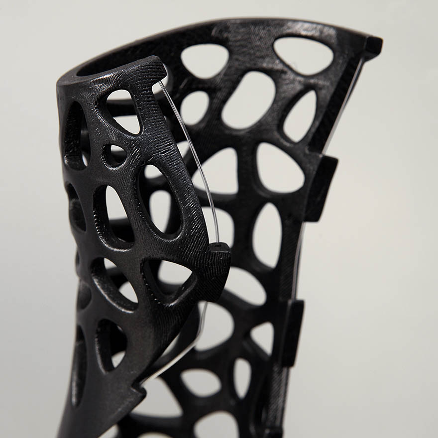 3D-Printed Plastic Cast Looks Awesome And Uses Ultrasound To Heal Broken Bones Faster